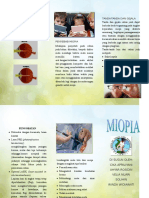 Mengerti Miopia dan Cara Mencegahnya