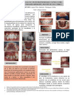 Camuflaje Dental