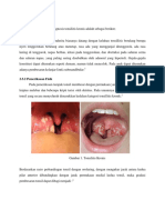 Diagnosis DKK