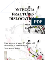 Monteggia Fracture-Dislocation: Agria Narayanan Roll No.8