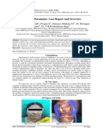 Maxillary Paramolar: Case Report and Overview