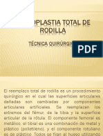 Artroplastia Total de Rodilla Tecnica Quirurgica