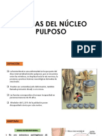 Hernia de Nucleo Pulposo