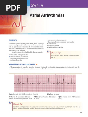Ecg Mastery Improving Your Ecg Interpretation Skills Pdf Electrocardiography Atrium Heart