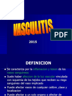 vasculitis