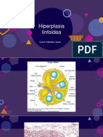 Hiperplasia linfoidea