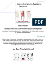 Dental Caries Causes Symptoms Types Treatment
