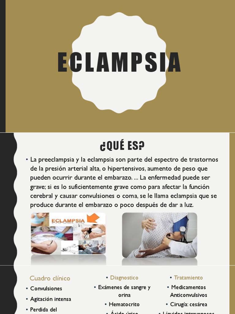 Eclampsia PDF Rtt Medicina CLINICA