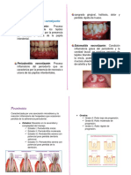 Clasificacion Periodontal