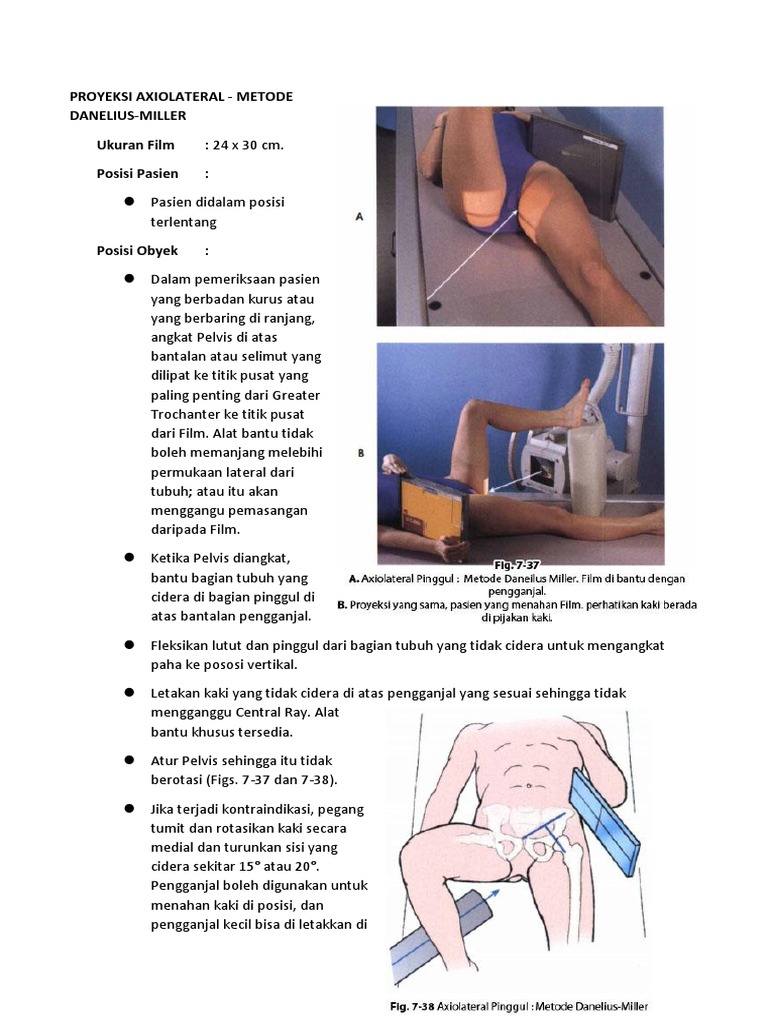 Teknik Radiografi Axiolateral Pinggul | PDF | Sains & Matematika