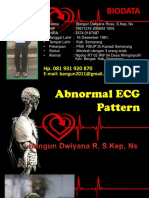 Abnormal ECG