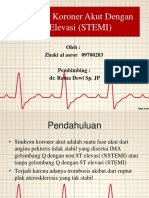 STEMI Fix