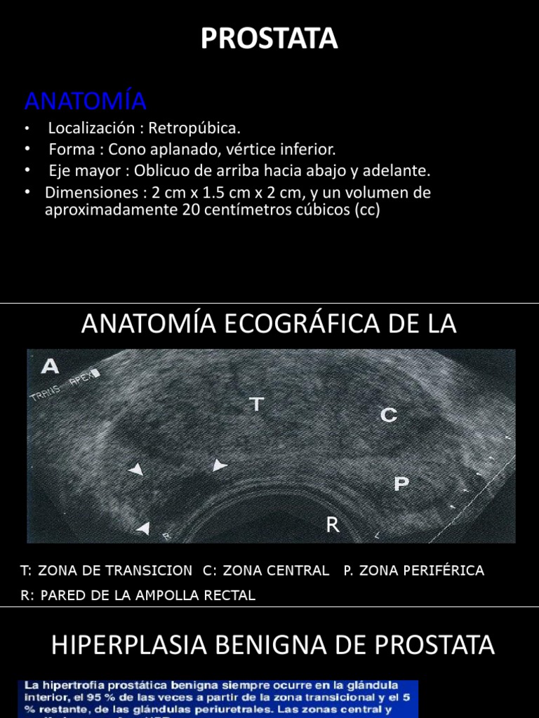 anatomía ecográfica de la próstata