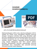 Elektrokardiogram (Ekg)