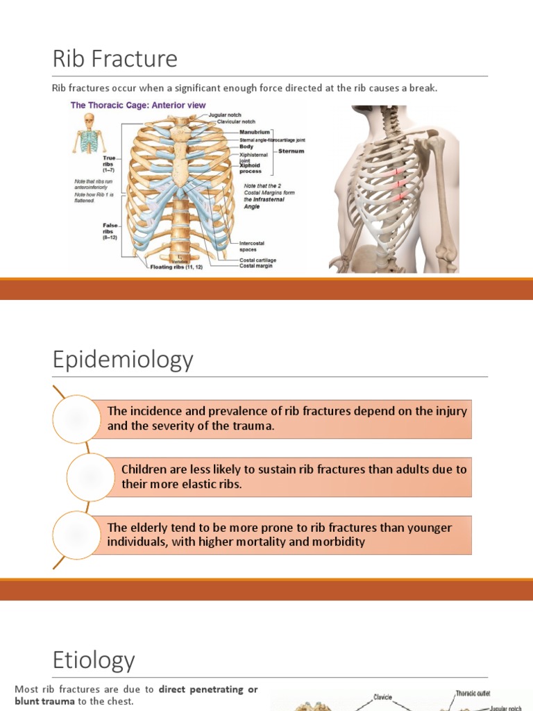 Rib Fracture | PDF | Thorax | Surgery