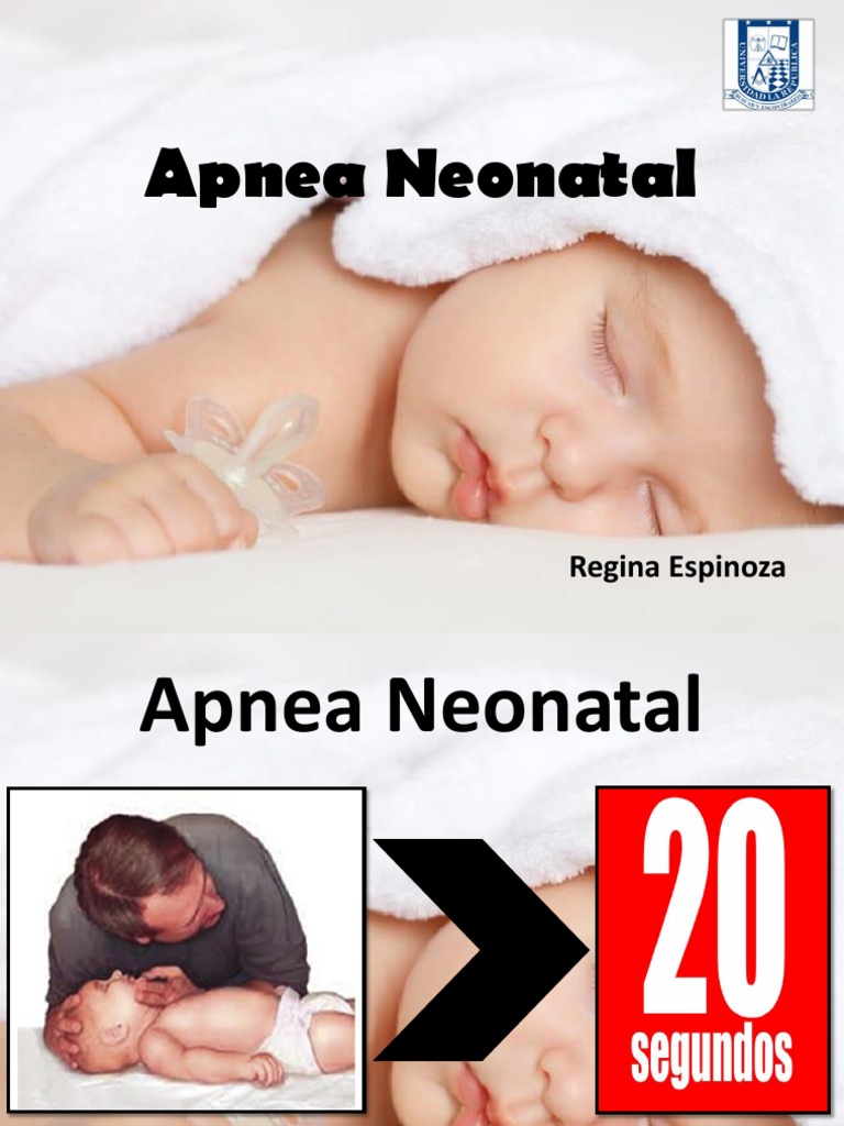 Apnea Neonatal: Tipos y Tratamientos | PDF | Apnea | Especialidades Medicas