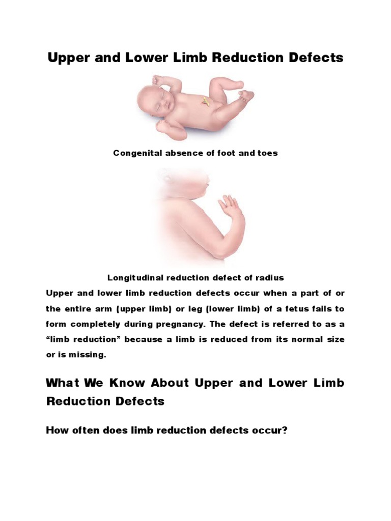 Upper and Lower Limb Reduction Defects | PDF | Therapy | Pregnancy