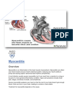 Myocarditis