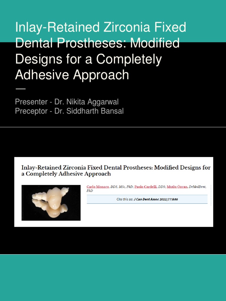 Inlay Retained FPD | PDF | Dental Implant | Dental Composite