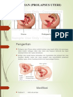 Penyuluhan (Prolapsus Uteri) Di Poliklinik Obgyn