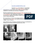 Resumen 07-11-17 Osificación heterotropica