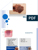 Melanomas