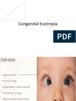 Congenital Esotropia