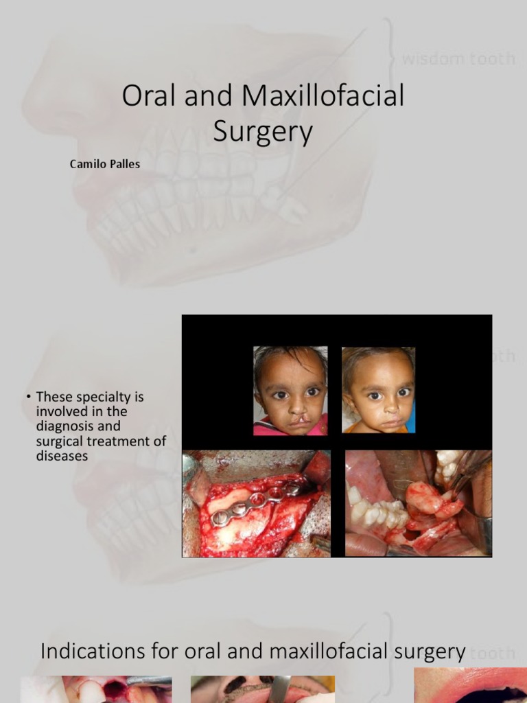 Oral and Maxillofacial Surgery | PDF