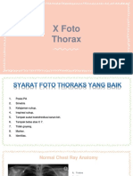 X Foto Thorax