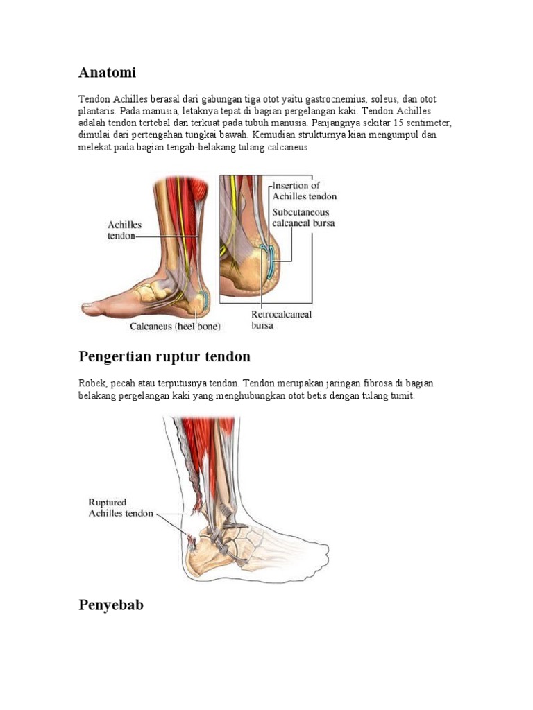 ASKEP RUPTUR TENDON ACHILLES PDF