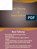  Bayi Tabung