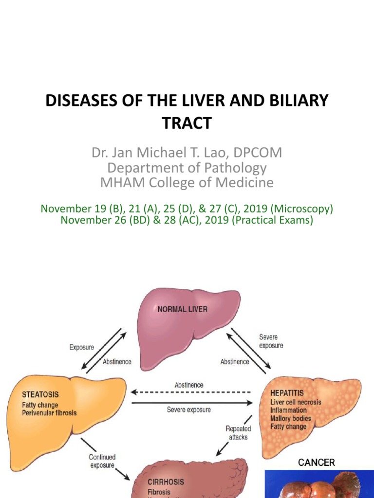 Liver Diseases PDF Liver Cirrhosis