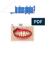 Flipchart Gingiva