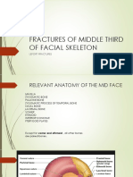 Fractures of Middle Third of Facial Skeleton