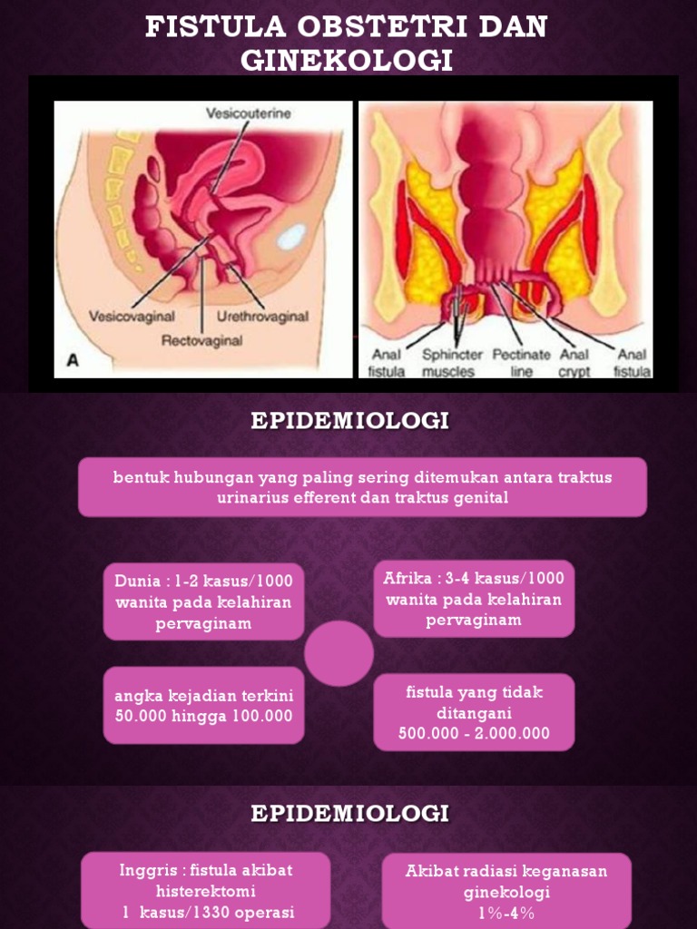 Yalangoch qoshiqchi Marta