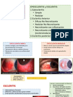 Epiescleritis y Escleritis 