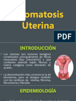 Miomatosis Uterina