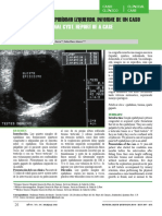 Uro Quiste Gigant Epididimo PDF