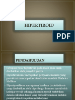 hipertiroid