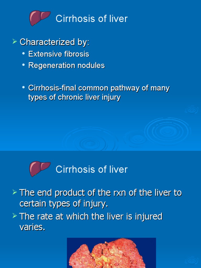 Cirrhosis of Liver: Characterized by | PDF | Cirrhosis | Liver