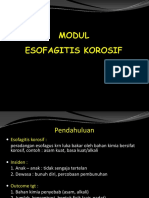 Esofagitis