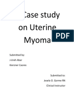 Uterine Myoma