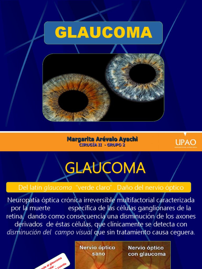 Glaucoma: Tipos y Fisiopatología | PDF | Glaucoma | Ojo humano
