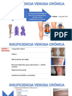 Insuficiencia Venosa Crónica