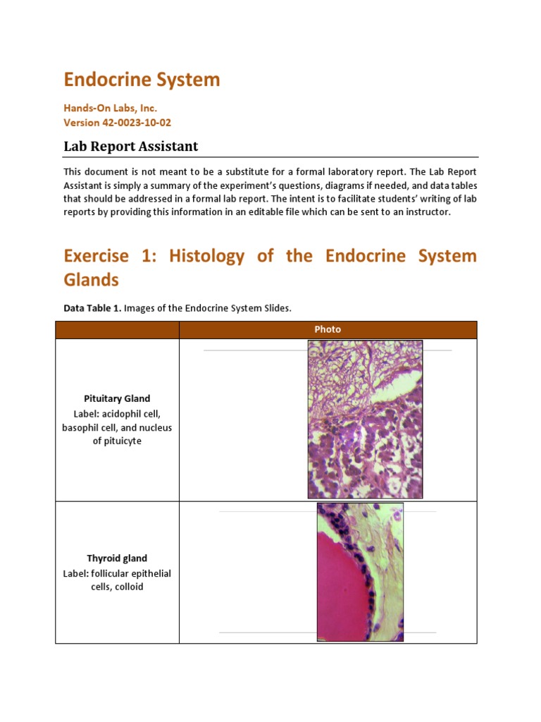 Lab Report Assistant Endocrine System Luteinizing Hormone Hormone
