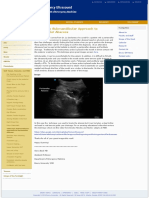 Telescopic Submandibular Approach to Peritonsillar Abscess.pdf