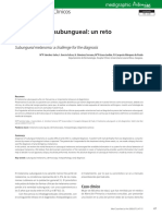 melanoma ungueal.pdf