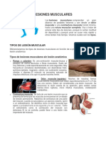 Tipos de Lesiones