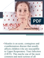 measles ppt