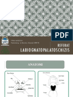 Referat Labiognatopalatoschizis FITRIA